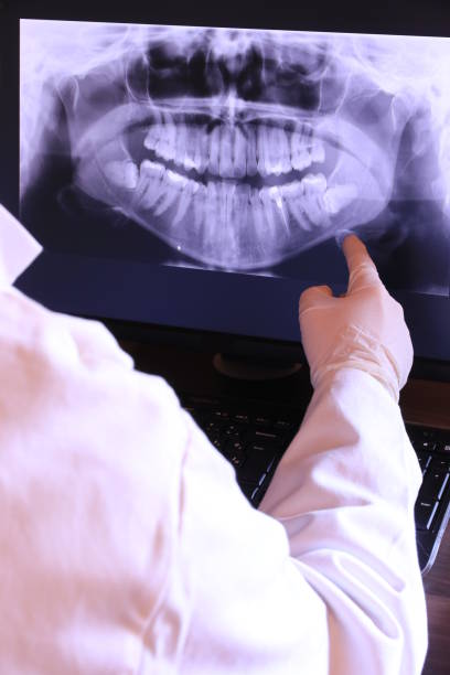 Best Dentist for Tooth Abscess  in Dover, AR