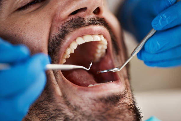 Best Emergency Gum Pain Relief  in Dover, AR