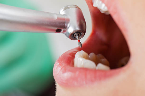 Best Knocked-Out Tooth Emergency  in Dover, AR